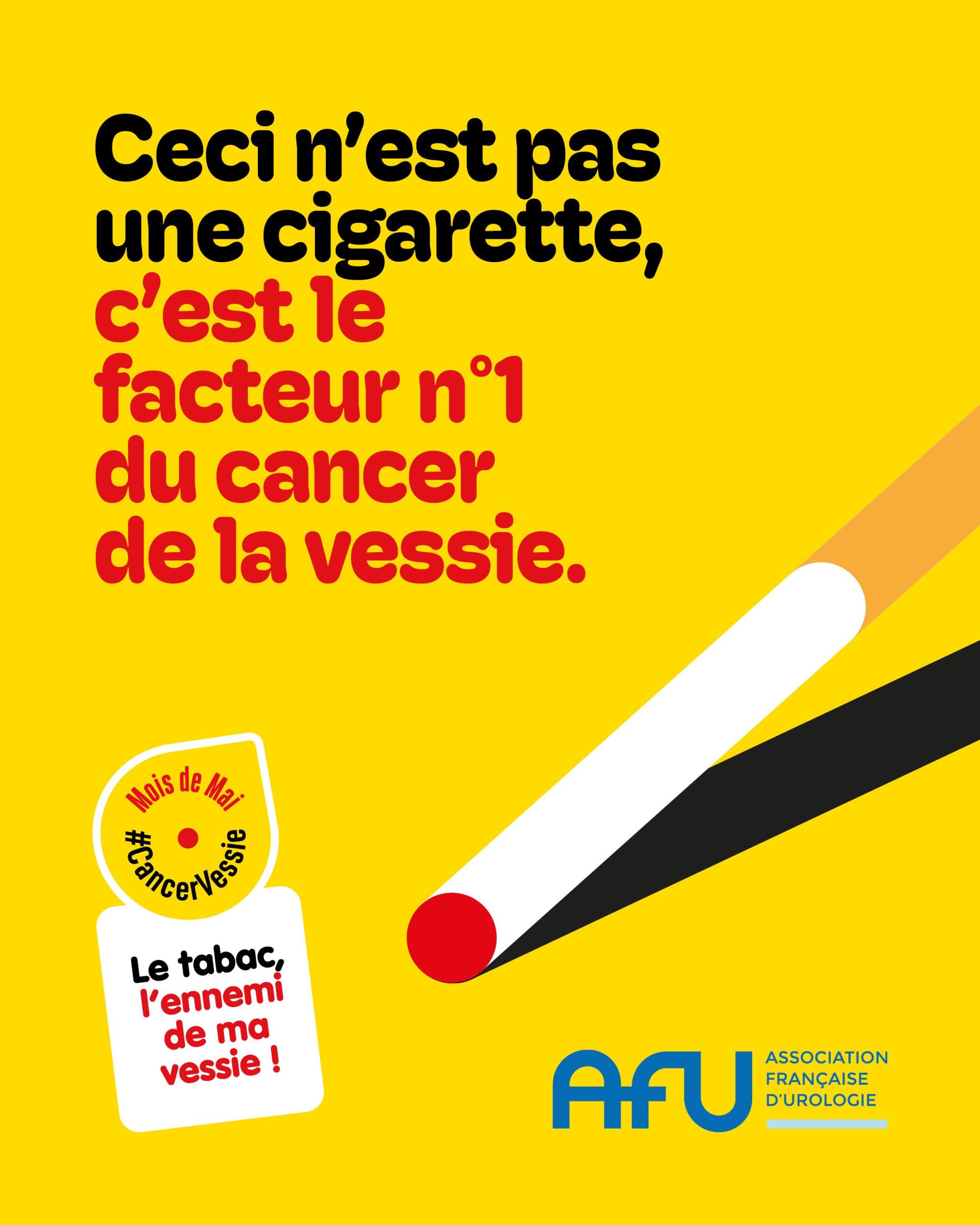AFU cancer vessie 2025 - 1080x1350 tabac-compressed