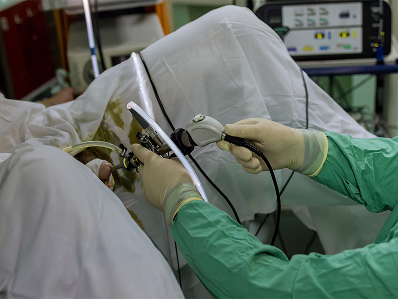 Opération de la prostate à Cannes - HoLEP, Rezum1